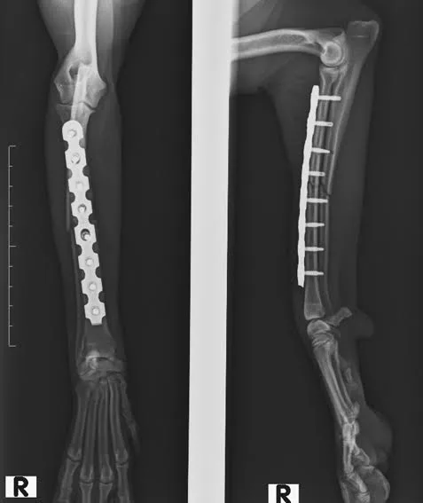 C0003 Fracture Repair Mid-Shaft Radius