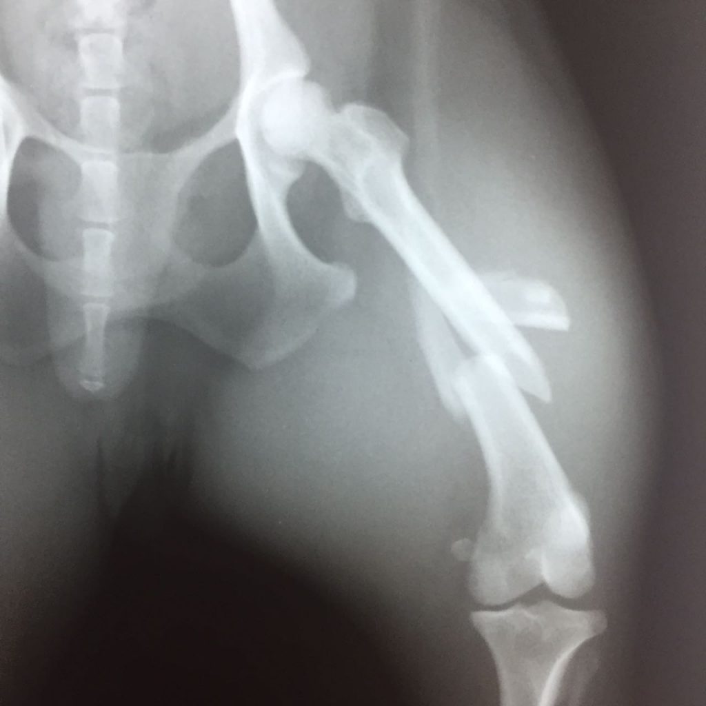 C0004 Fracture Repair Mid-Shaft Femur