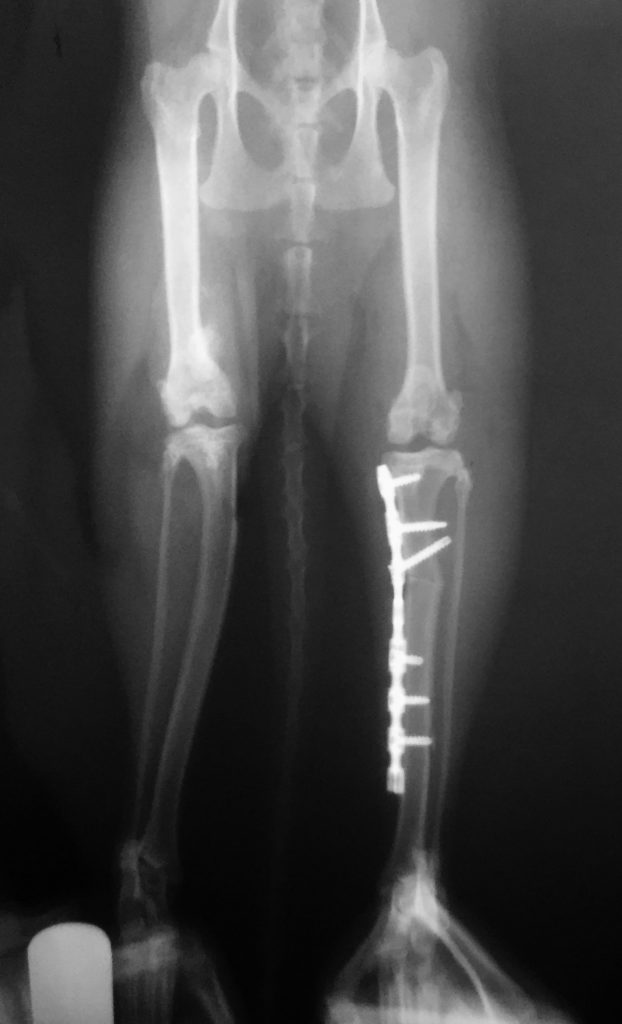 Osteotomy Tibia C0008