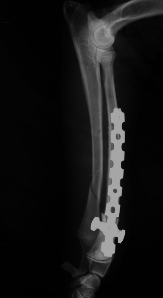 Distal Radius C0009