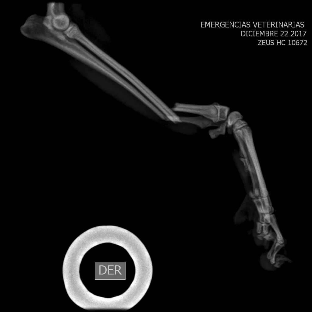 Distal Radius C0010