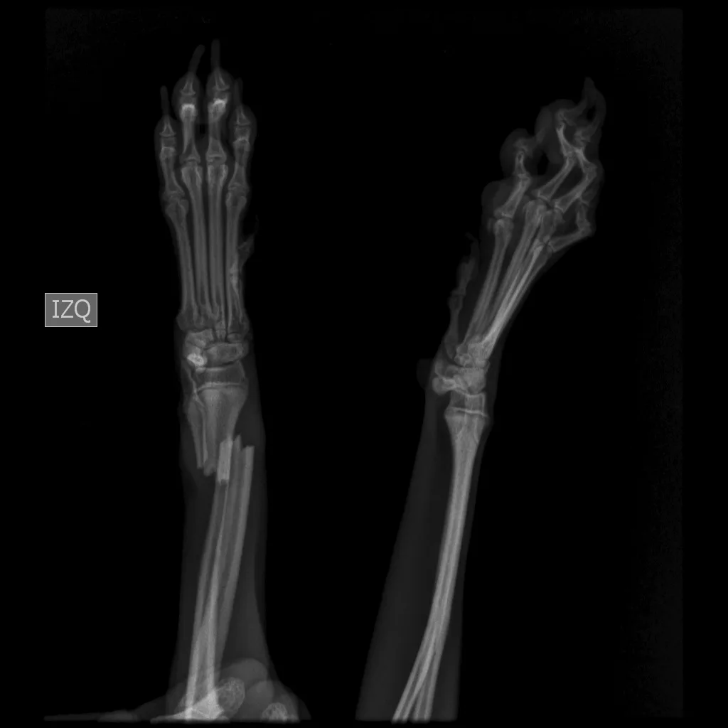 Distal Radius C0012