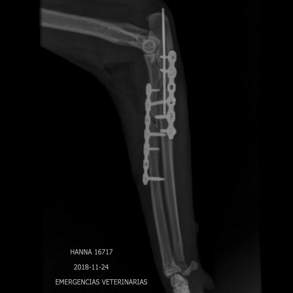 Proximal Radius / Ulna C0015