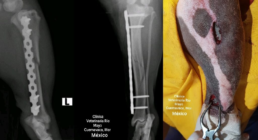 Mid-Shaft Tibia C0021