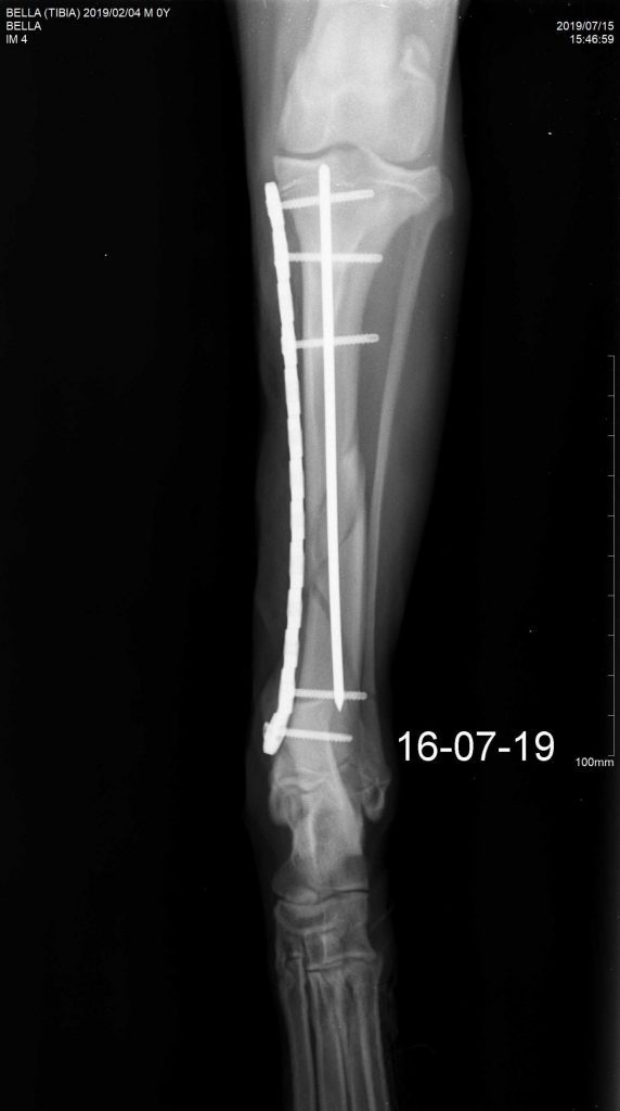 Mid-Shaft Tibia C0018