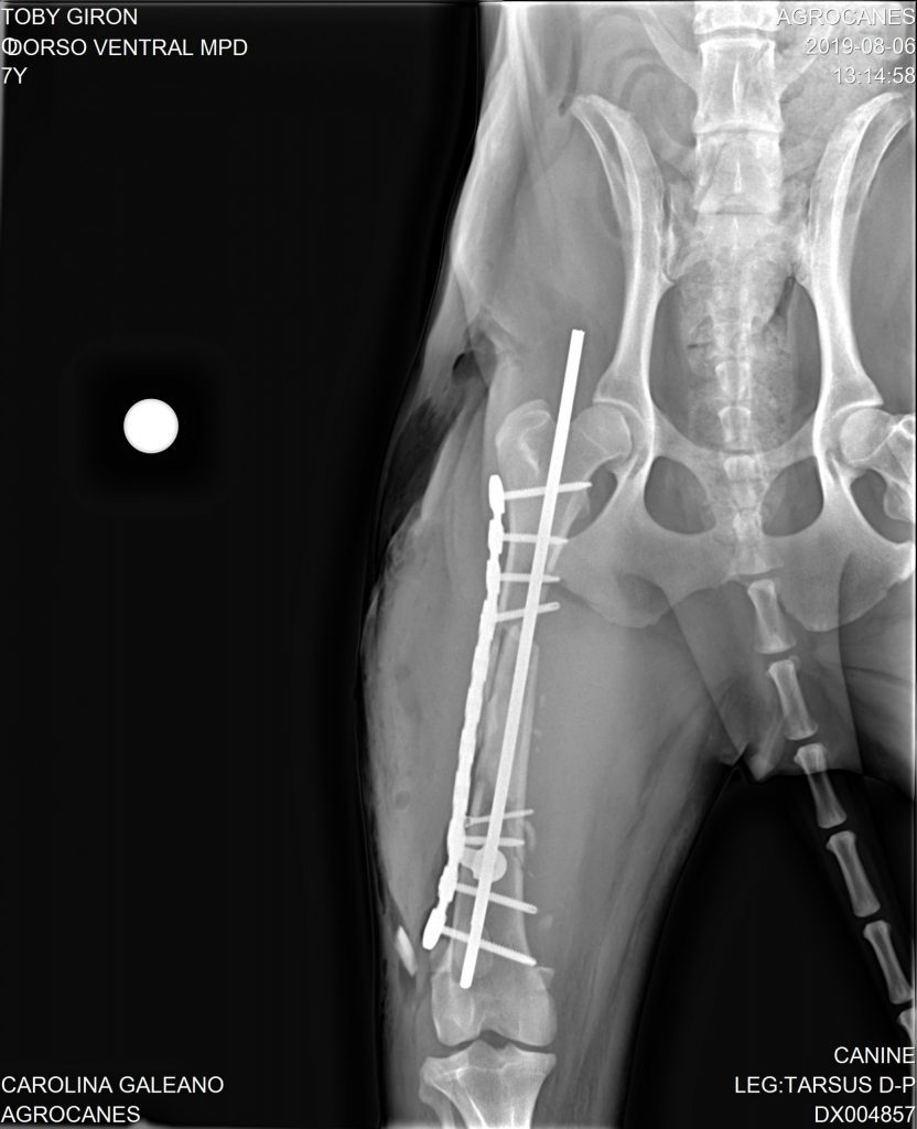 Mid-Shaft Femur C0019