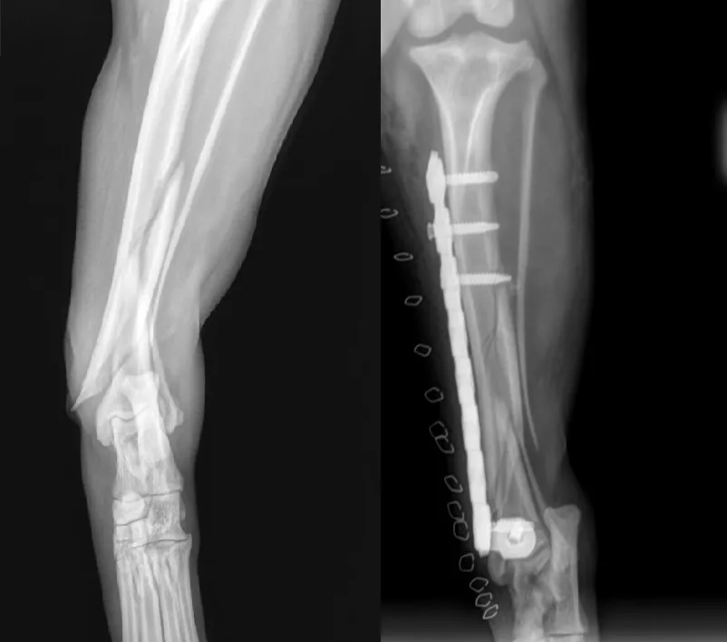 Distal Tibia C0023