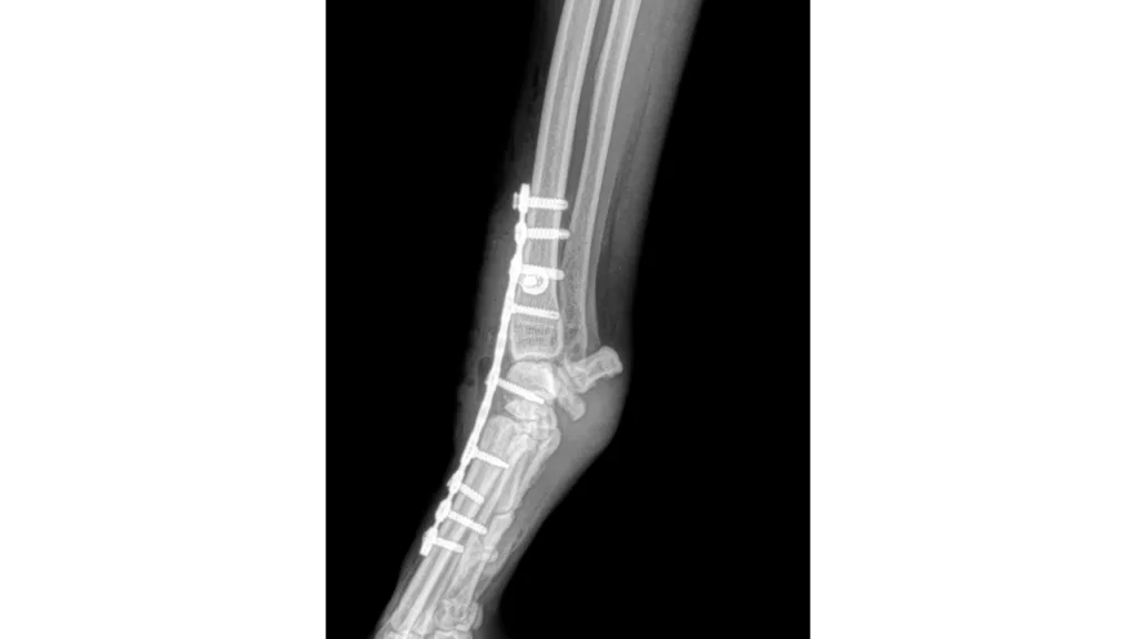 Carpal Arthrodesis C0013