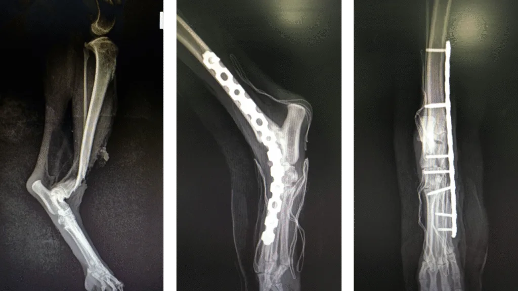 Arthrodesis Tarso C0059