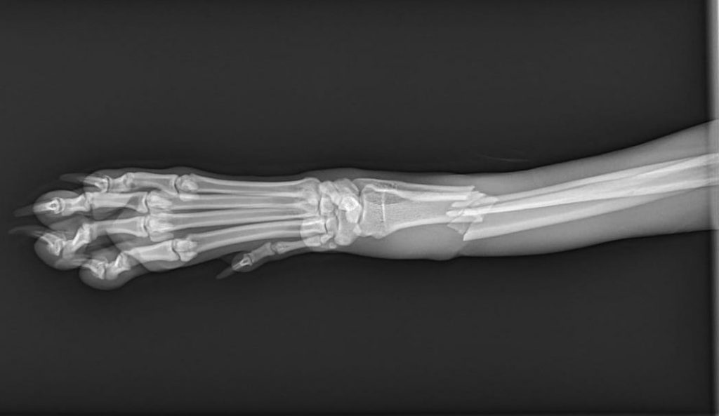 Distal Radius C0024