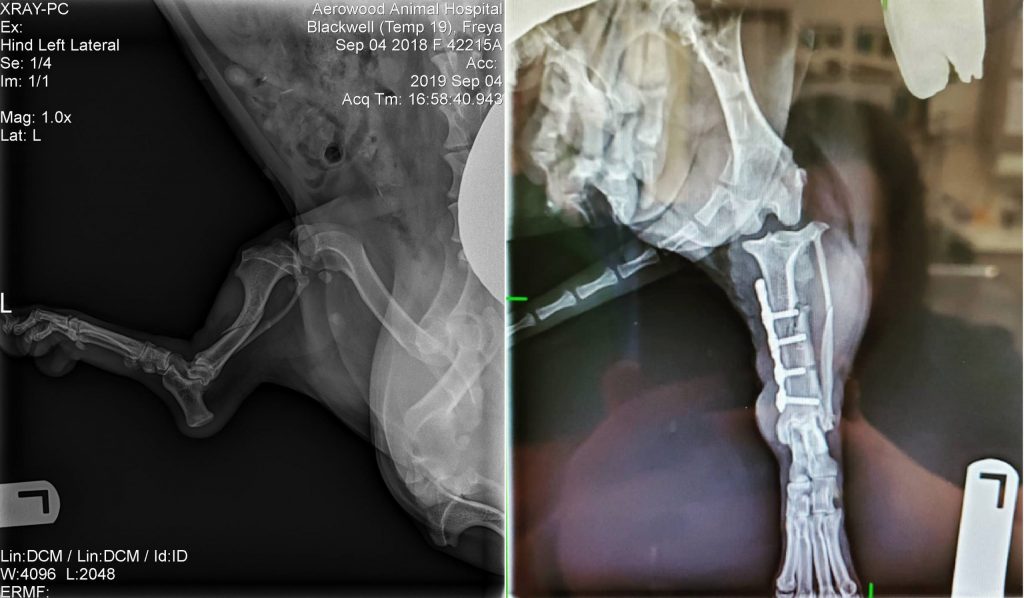 Mid-Shaft Tibia C0025