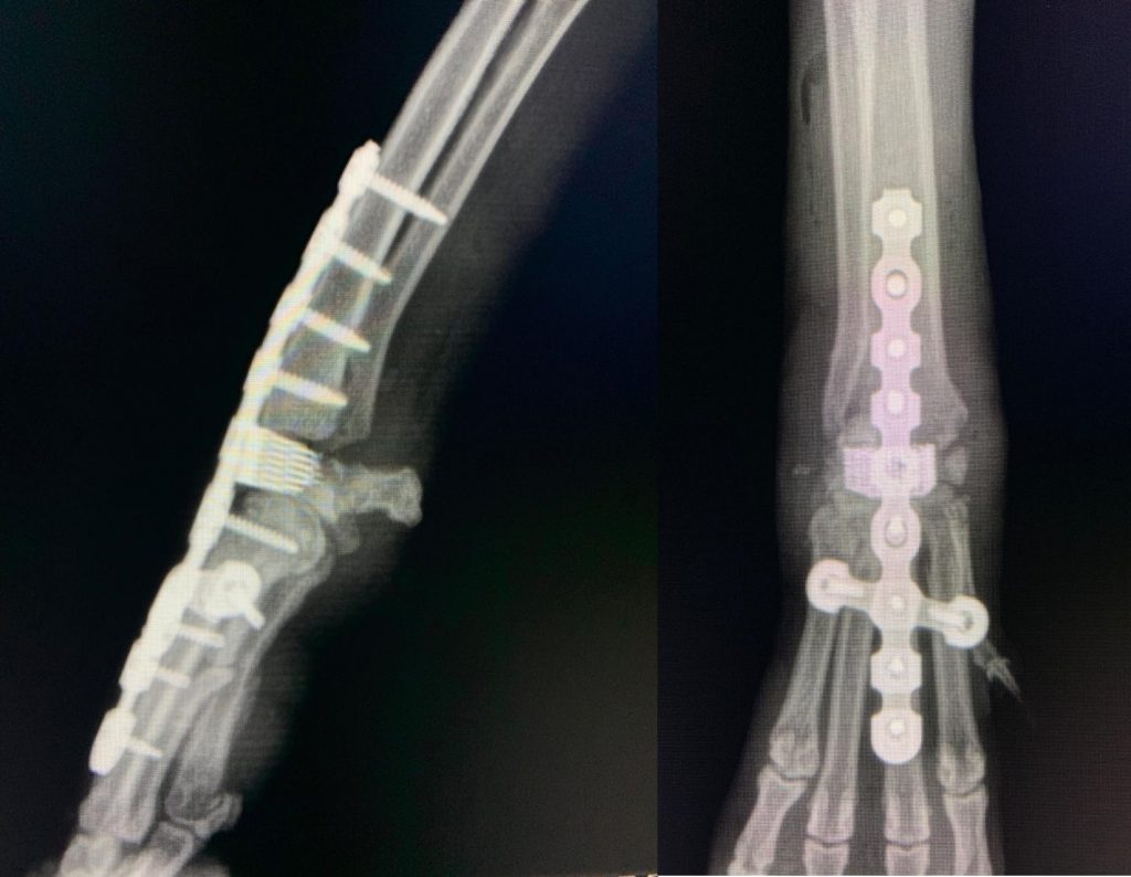Arthrodesis Carpus C0026