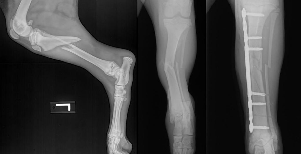 Mid-Shaft Tibia C0028