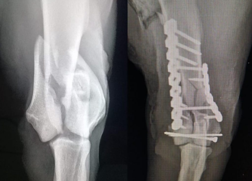 Distal Humerus C0029