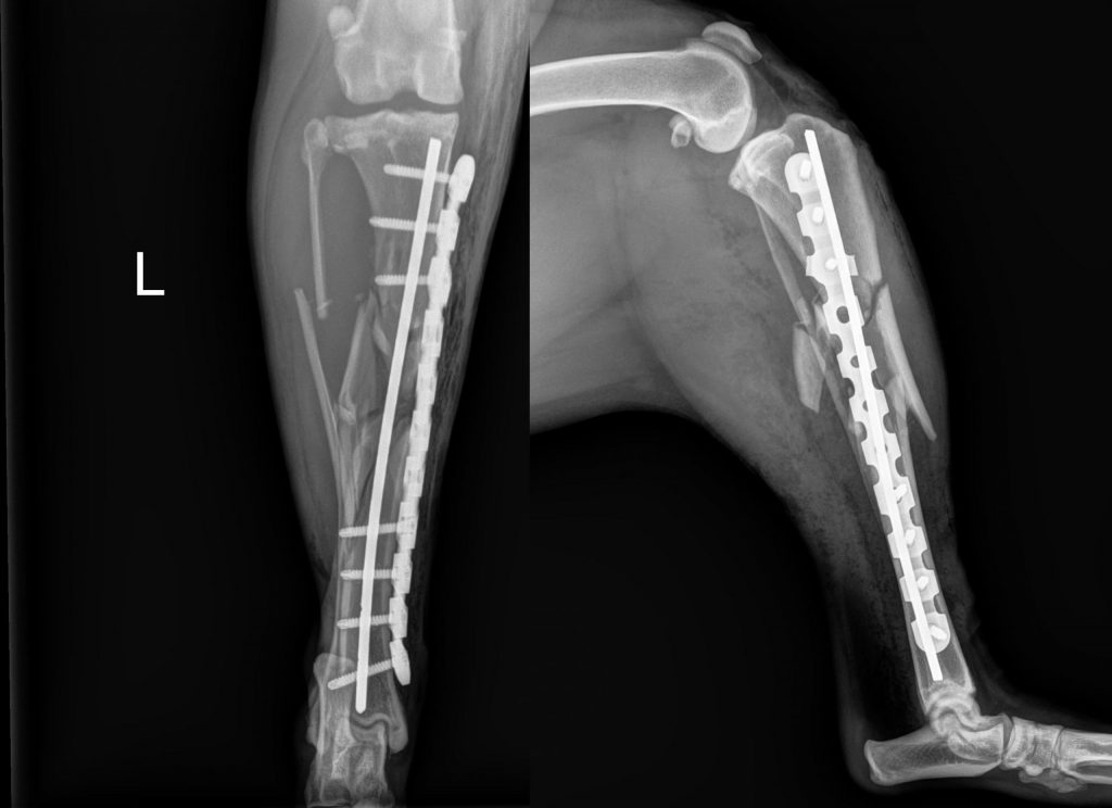 Mid-Shaft Tibia C0030