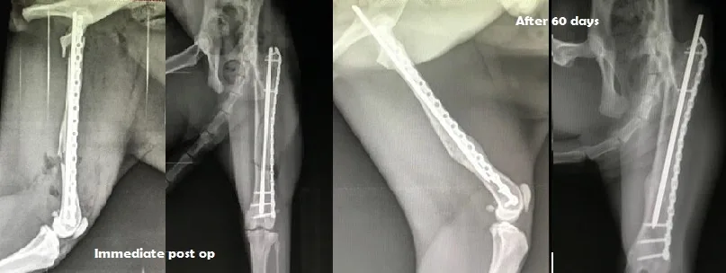 Mid-Shaft Femur C0031