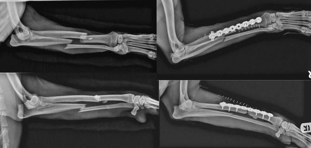 Mid-Shaft Radius / Ulna C0033