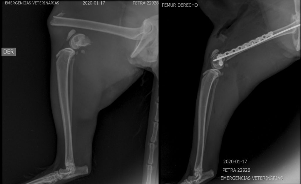 Distal Femur C0034