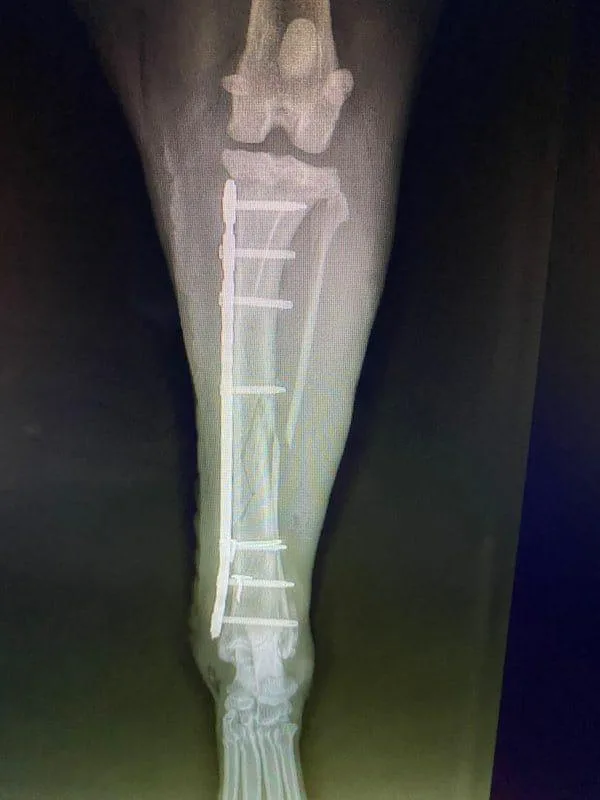 Mid-Shaft Tibia C0035