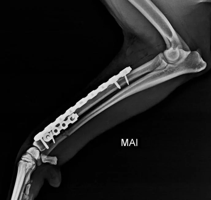 Distal Radius / Ulna C0039