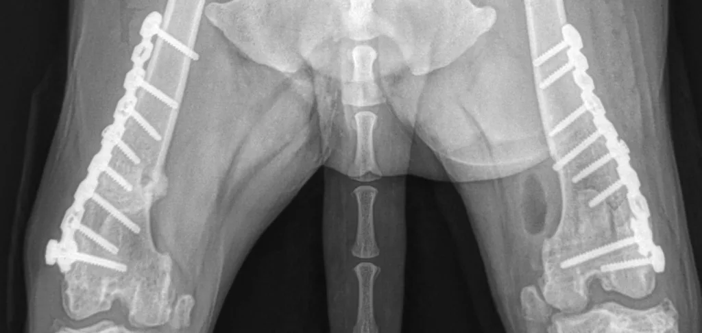 Bilateral lateral  Femoral Osteotomy / bilateral/patellar luxation C0043