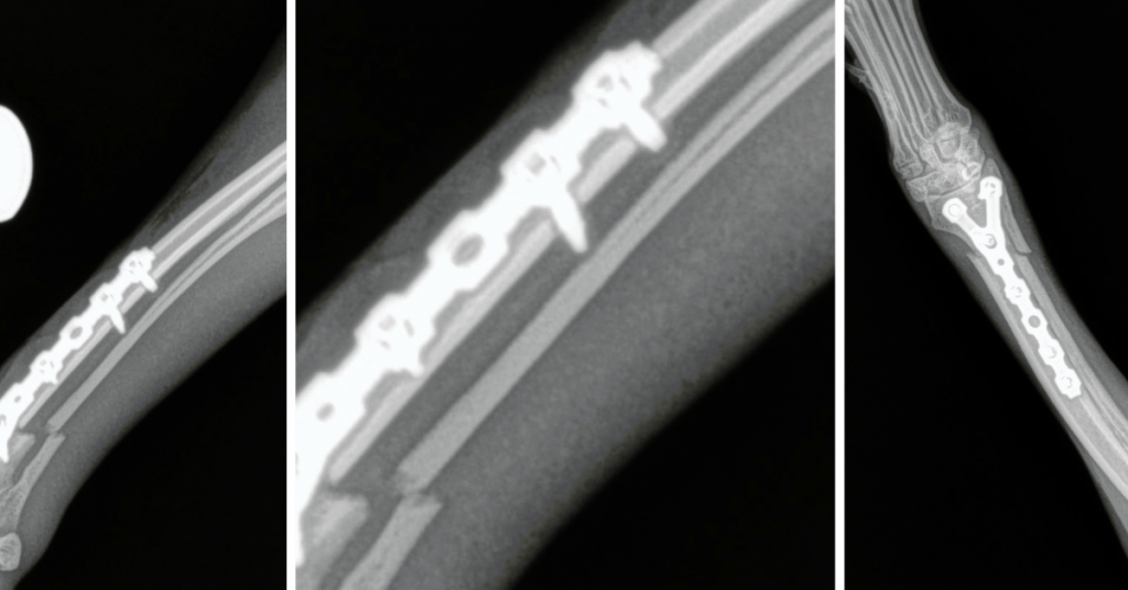 Distal Radius C0044