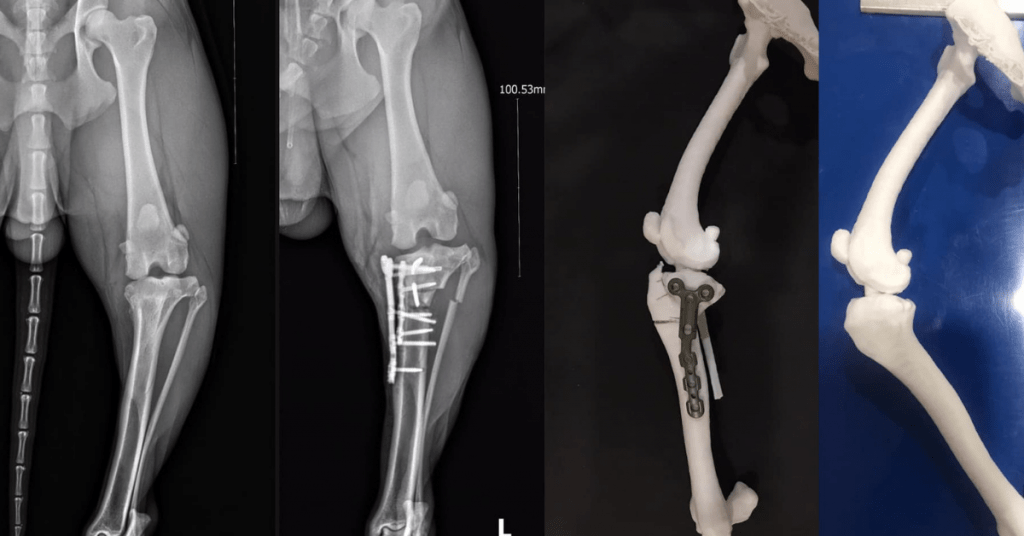 Proximal Tibia C0045