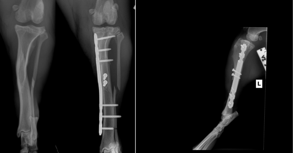 Mid-Shaft Tibia C0053
