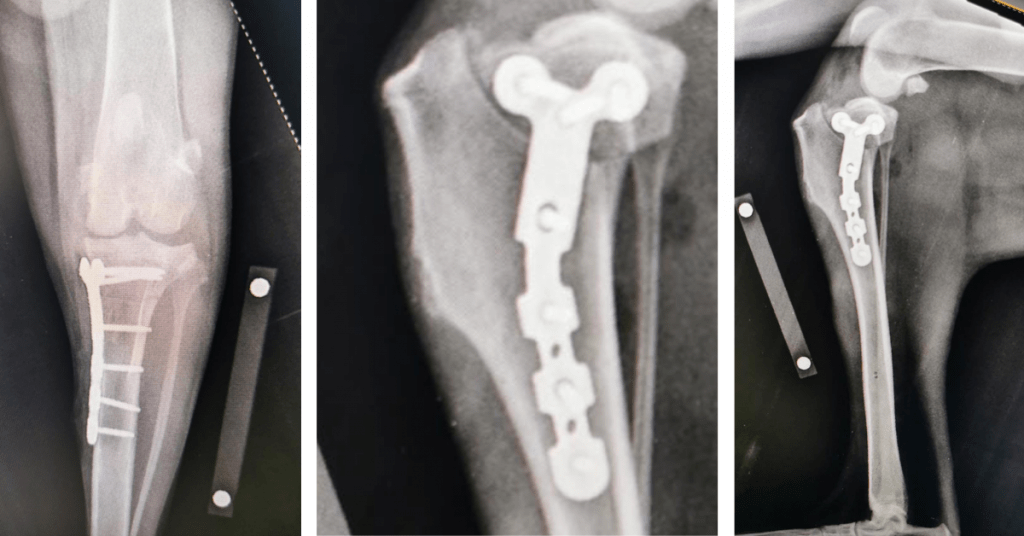 Proximal Tibia C0051