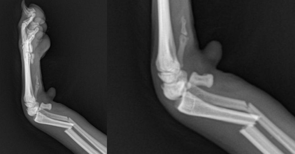 Distal Radius C0050