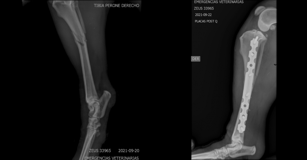 Mid-Shaft Tibia C0054