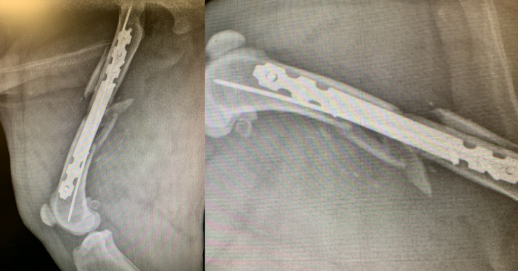 Mid-Shaft Femur C0056