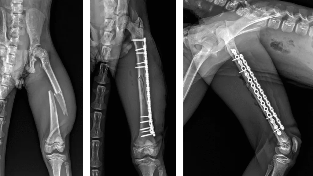 Mid-Shaft Femur C0058