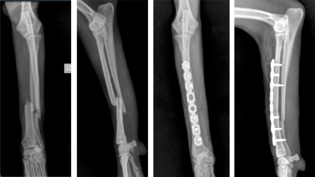 Mid-Shaft Radius/Ulna C0060