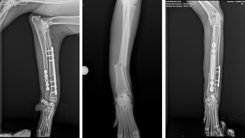 Fracture Repair Mid-Shaft Radius / Ulna C0061