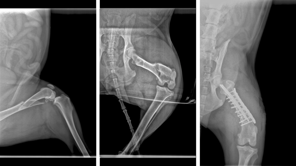 Fracture Repair Mid-Shaft Femur C0062
