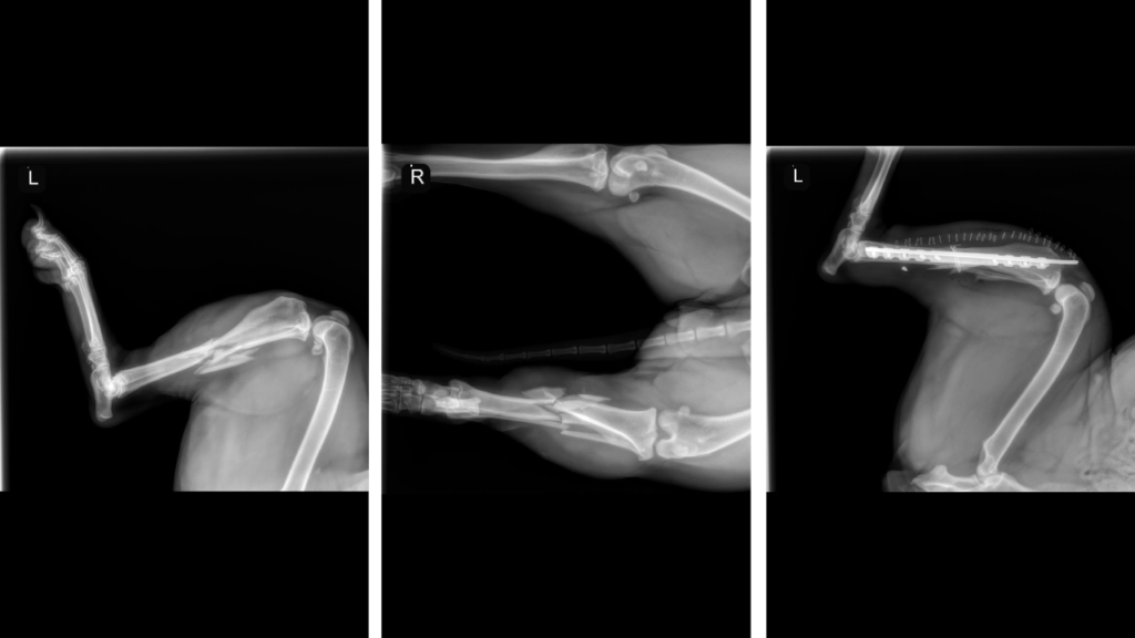 Arthrodesis C0065