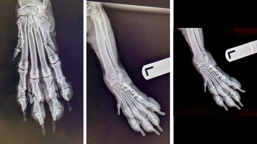Fracture Repair Mid-Shaft Metatarsal C0066