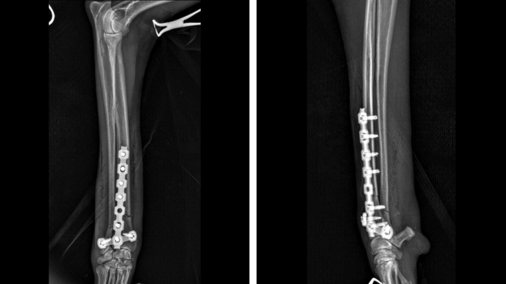 Fracture Repair Mid-Shaft Tibia C0069