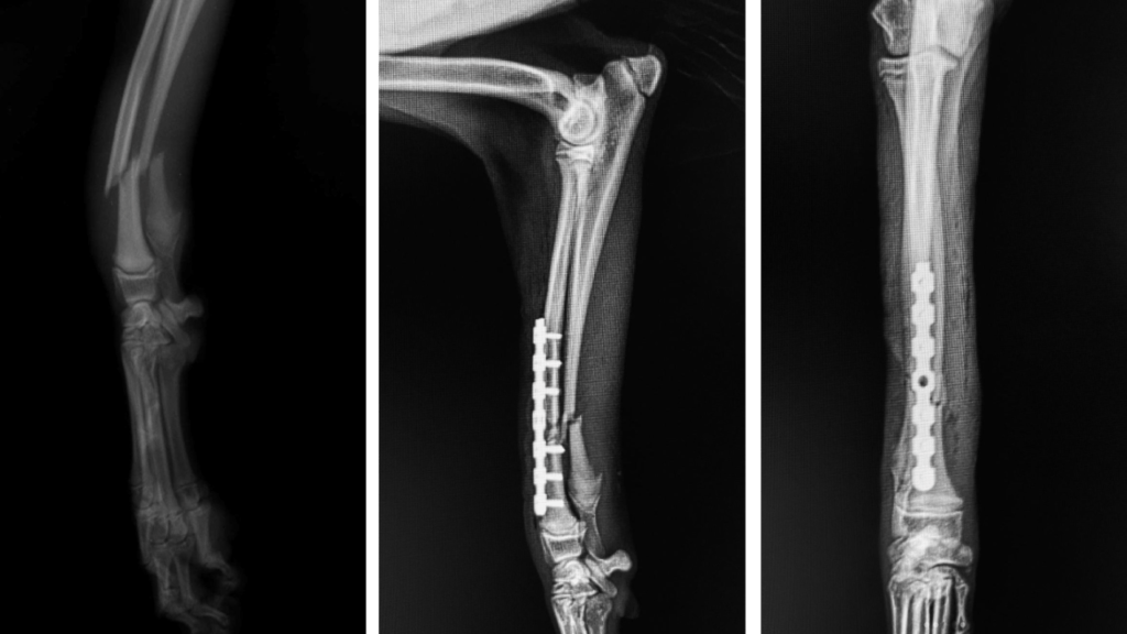 Fracture Repair Mid-Shaft Radius C0072