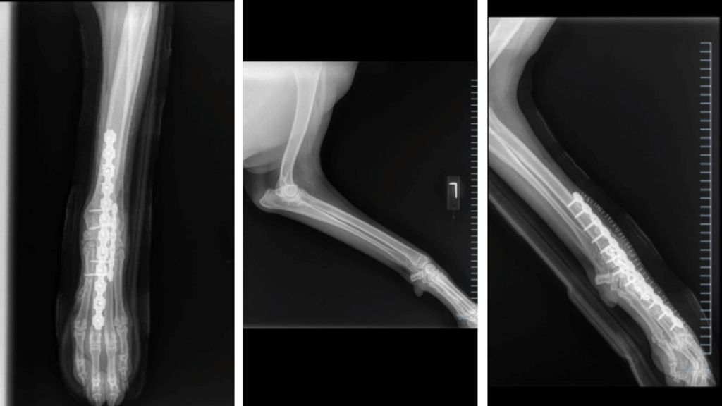Fracture Repair Mid-Shaft Tibia C0074