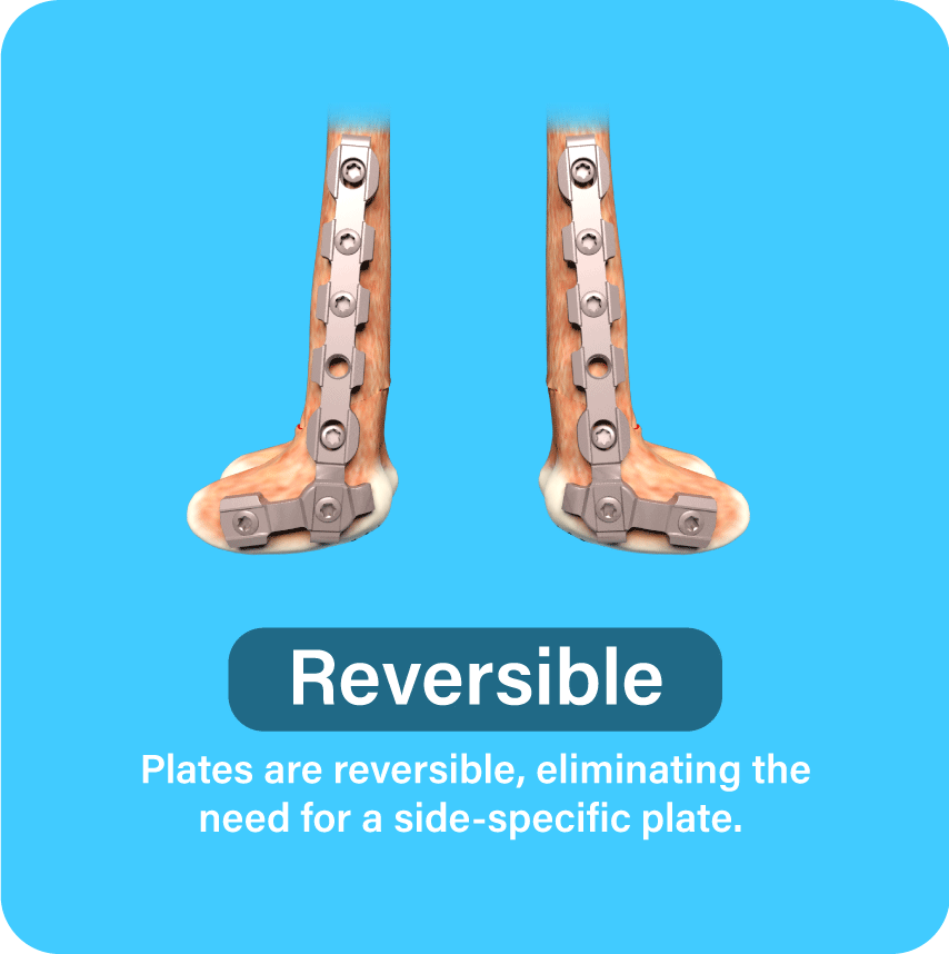 Reversible: Plates are reversible, eliminating the need for a side-specific plate.