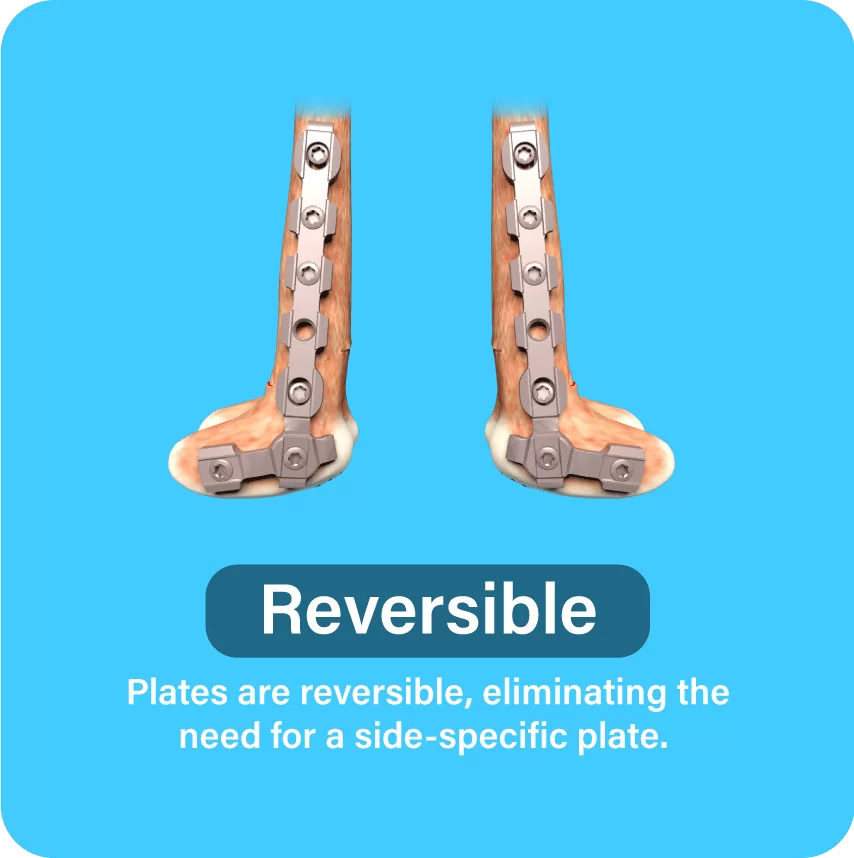 Reversible: Plates are reversible, eliminating the need for a side-specific plate.