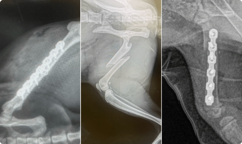 Fracture Repair Mid-Shaft Femur C0082