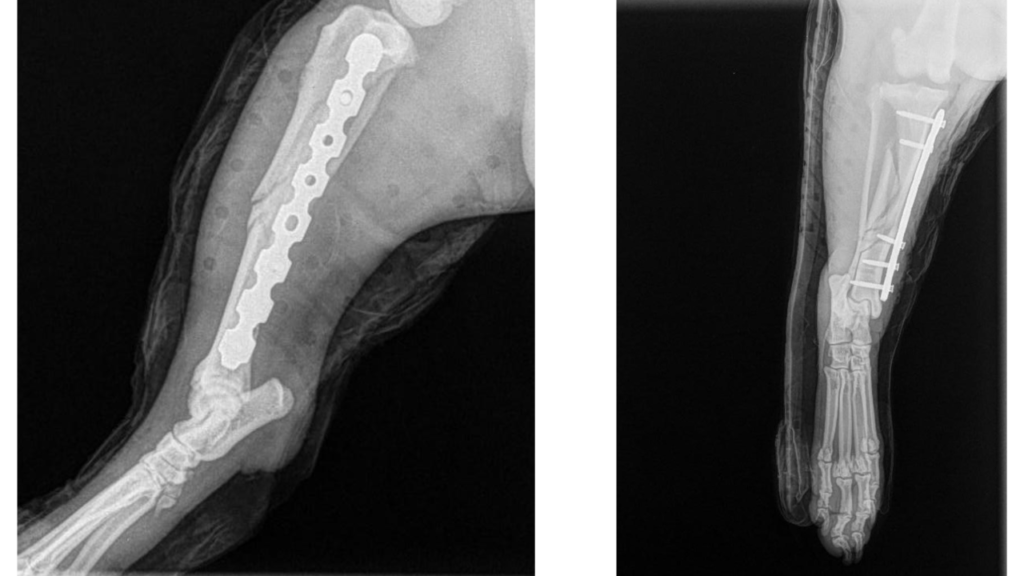 Fracture Repair Mid-Shaft Tibia C0084