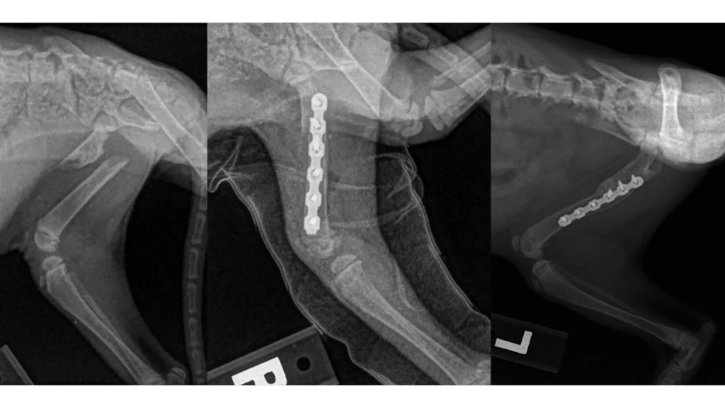 Fracture Repair Mid-Shaft Femur C0085