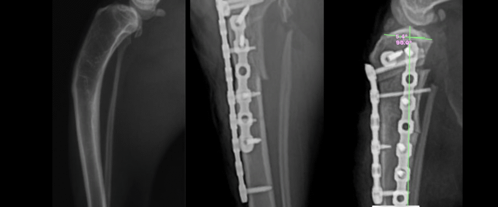 Corrective Osteotomy Proximal Tibia C0089