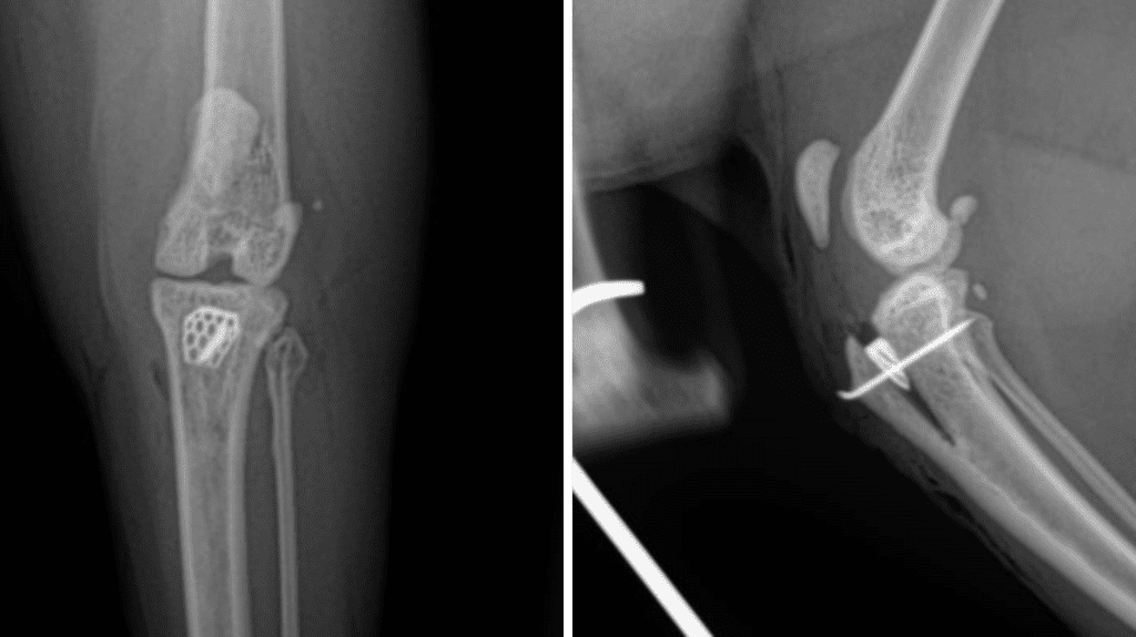 TTA Proximal Tibia C0090
