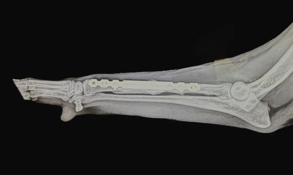 Fracture Reapir Mid-Shaft Radius C0091