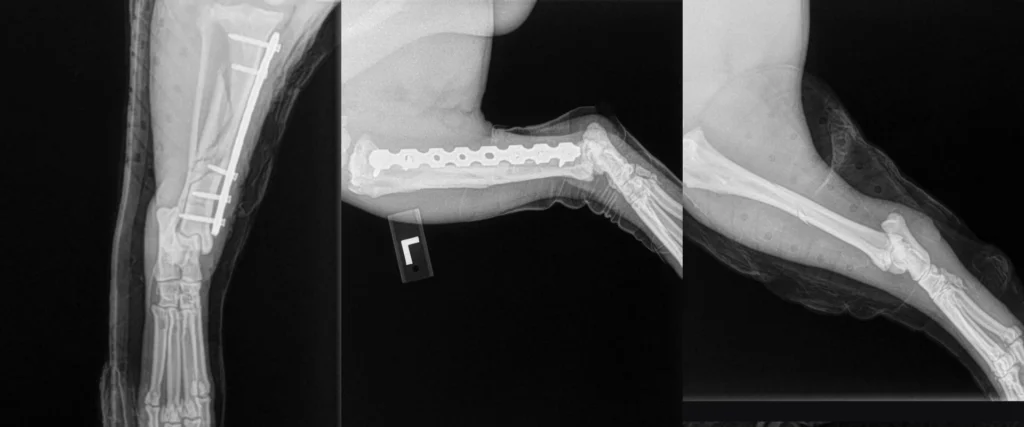 C0094 Fracture Repair Mid-Shaft Radius / Ulna